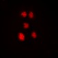 Anti-ZNF148 Antibody