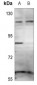 Anti-ZNF148 Antibody
