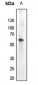 Anti-AKT (pY474) Antibody