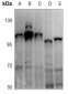 Anti-ATP1A1 (pS16) Antibody