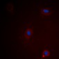 Anti-Ataxin 1 (pS775) Antibody