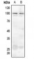 Anti-Ataxin 1 (pS775) Antibody