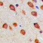 Anti-Aurora A (pT288) Antibody