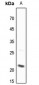 Anti-BID Antibody