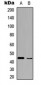 Anti-BMP2 Antibody