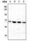 Anti-BMP6 Antibody