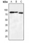 Anti-BMX (pY566) Antibody