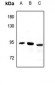 Anti-CPT1B Antibody