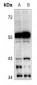 Anti-Cytochrome P450 2C19 Antibody