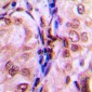 Anti-4EBP1 (pT69) Antibody