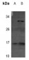 Anti-4EBP1 (pT69) Antibody