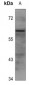 Anti-EPN2 Antibody