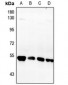 Anti-Fibulin 5 Antibody