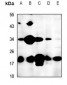 Anti-FTH1 Antibody