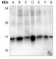 Anti-Histone H2B (AcK5) Antibody