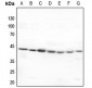 Anti-5-HT1F Antibody