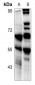 Anti-CD213a2 Antibody