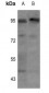 Anti-Insulin Receptor (pY1355) Antibody