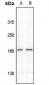 Anti-IRS1 (pS307) Antibody
