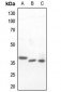 Anti-Islet-2 Antibody