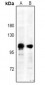 Anti-CD61 (pY785) Antibody