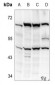 Anti-Kir2.1 Antibody