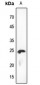 Anti-KDELR2 Antibody