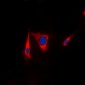 Anti-KSR1 Antibody