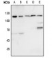 Anti-KSR1 Antibody
