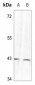 Anti-p38 (pY323) Antibody