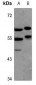 Anti-MEF2A Antibody