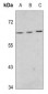 Anti-MEF2D (pS444) Antibody
