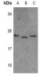 Anti-MRPL40 Antibody