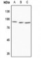 Anti-MTA1 Antibody