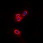 Anti-Merlin Antibody