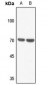 Anti-Merlin Antibody