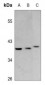 Anti-GPR120 Antibody