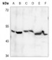 Anti-PDK2 Antibody