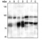 Anti-PFKM Antibody