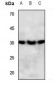 Anti-PPT Antibody