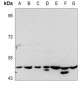 Anti-PTX3 Antibody