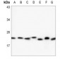 Anti-RAB6A Antibody