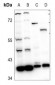 Anti-RRM2B Antibody