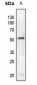 Anti-SGK1 (pS78) Antibody