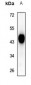 Anti-SIRT3 Antibody