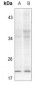 Anti-Alpha-synuclein (pY133) Antibody