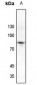 Anti-SP1 (pT739) Antibody