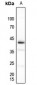 Anti-PU.1 Antibody