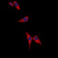 Anti-Tyrosine Hydroxylase (pS19) Antibody