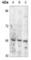 Anti-Tyrosine Hydroxylase (pS19) Antibody